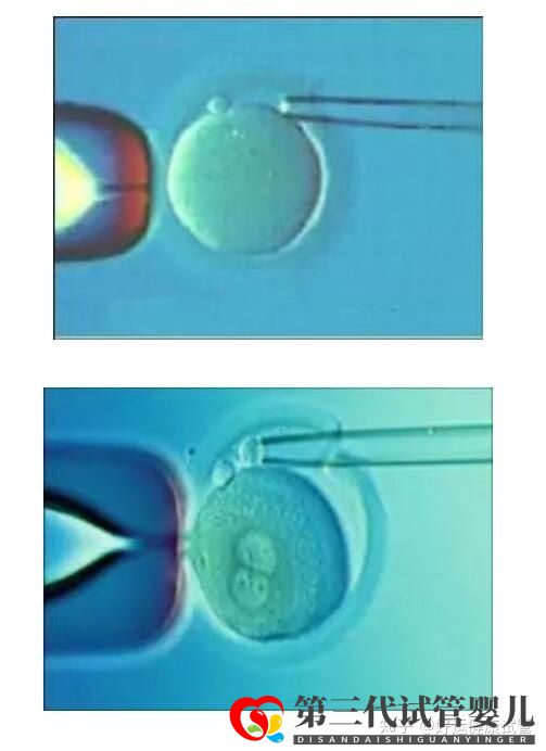 三代试管知男女的必经之路—胚胎活检术(图2)