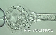 三代试管知男女的必经之路—胚胎活检术(图5)