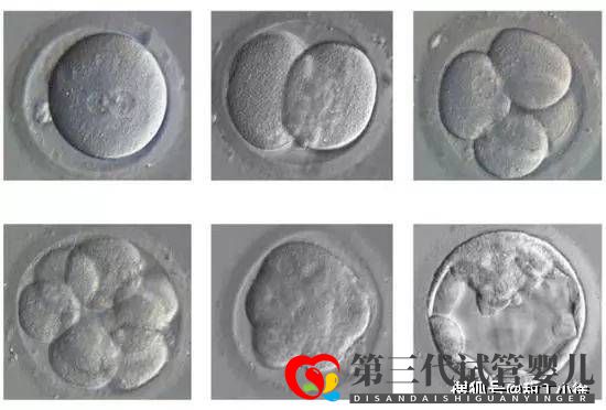 试管婴儿移植后多久算成功(图1)