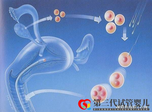 影响试管婴儿价格的因素有哪些(图1)