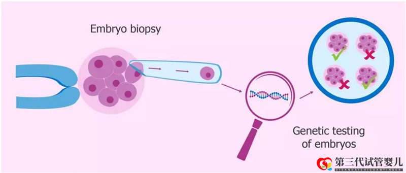 一个典型的PGD三代试管治疗周期是怎样的？(图1)