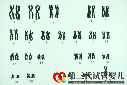 夫妻染色体正常，试管胚胎染色体异常的三个原因你都知道吗？(图2)