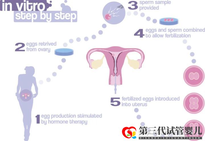 试管婴儿1代、2代、3代、4代哪个最好真实操作过...(图4) 试管婴儿1代、2代、3代、4代哪个最好真实操作过...(图4)