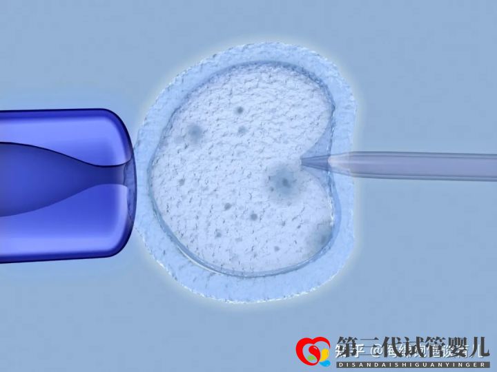 试管婴儿1代、2代、3代、4代哪个最好真实操作过...(图12) 试管婴儿1代、2代、3代、4代哪个最好真实操作过...(图12)