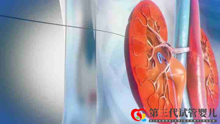 医学三维动画可以解决哪些问题(图1) 医学三维动画可以解决哪些问题(图1)