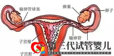 人工授精跟试管婴儿的区别(图3)