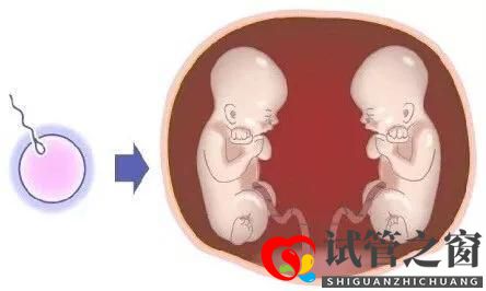 试管之窗:做试管婴儿，一次移植两个生双胞胎好不好？(图3)