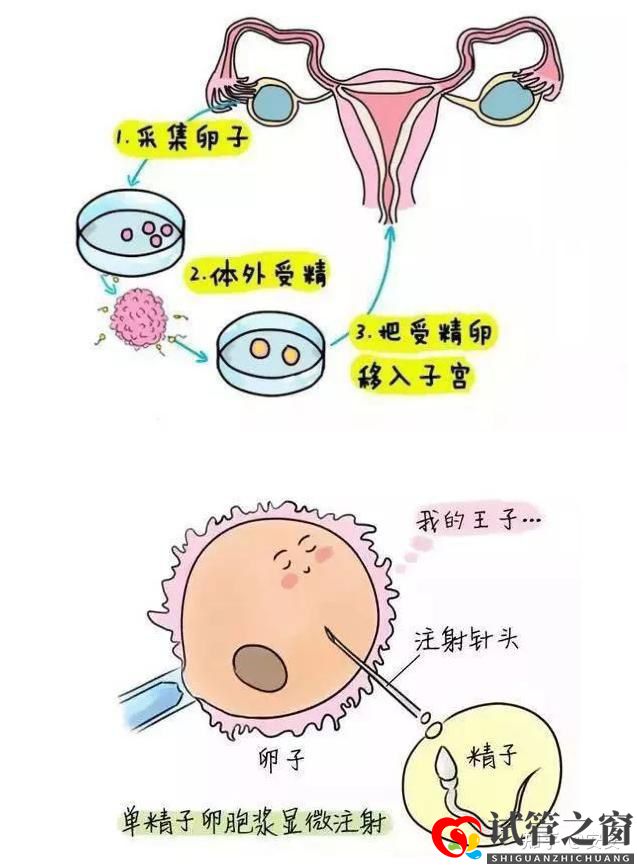“试管婴儿又不是亲生的,多丢人”(图1)