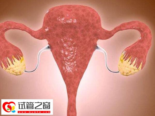 子宫内膜异位有哪些表现