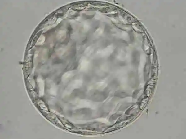 胚胎移植后要注意观察雌二醇值