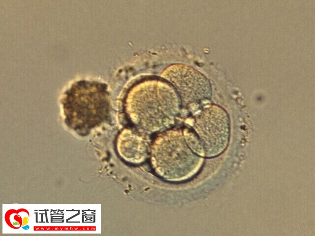 试管婴儿移植后孕酮和雌二醇正常值是多少(图1) 囊胚移植后雌二醇正常值比较高