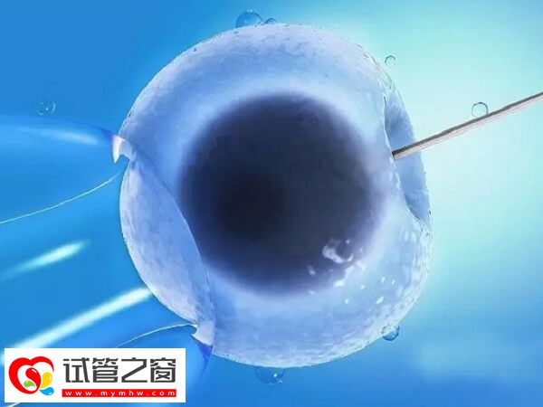 试管婴儿可不可以避免遗传白化病(图1) 三代试管婴儿能避免遗传疾病