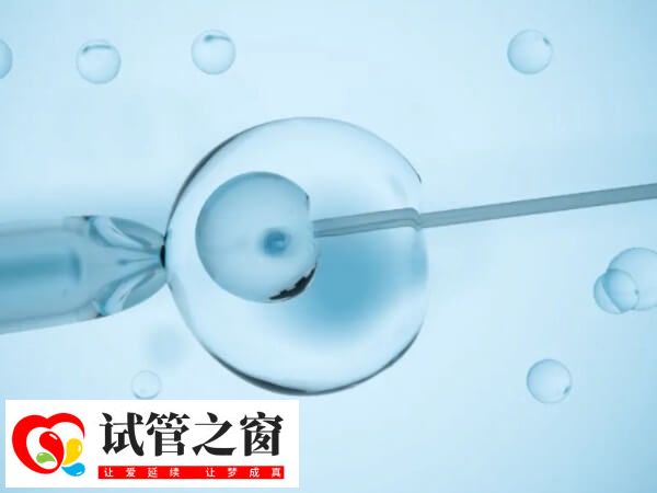 睾丸穿刺取精成功率约65%