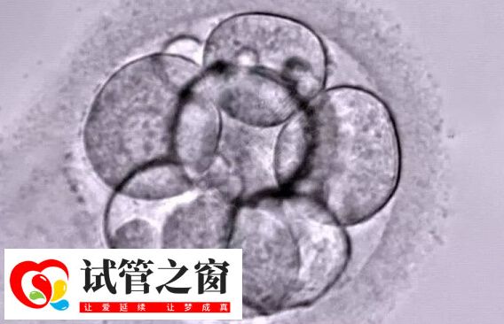 试管婴儿需要在体外进行胚胎培养