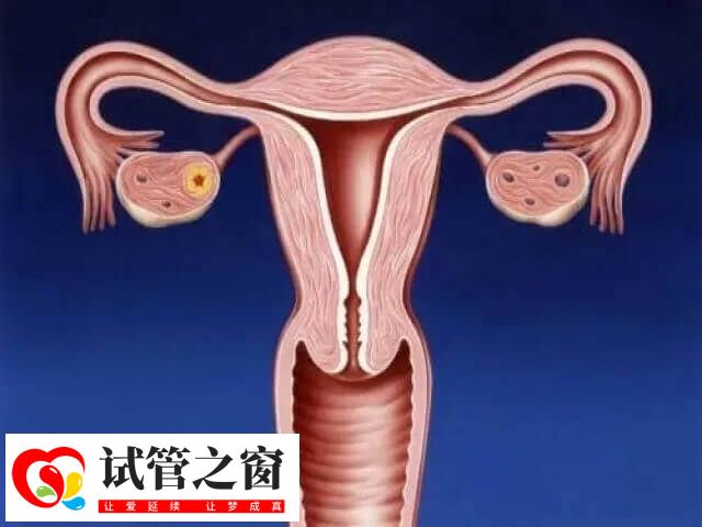子宫内膜薄做试管的成功案例不少