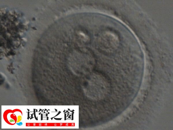 一代转二代是基于现有卵子的补救措施