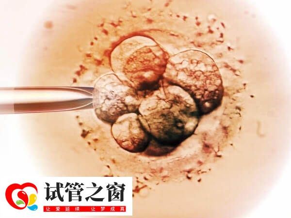 天津试管婴儿技术