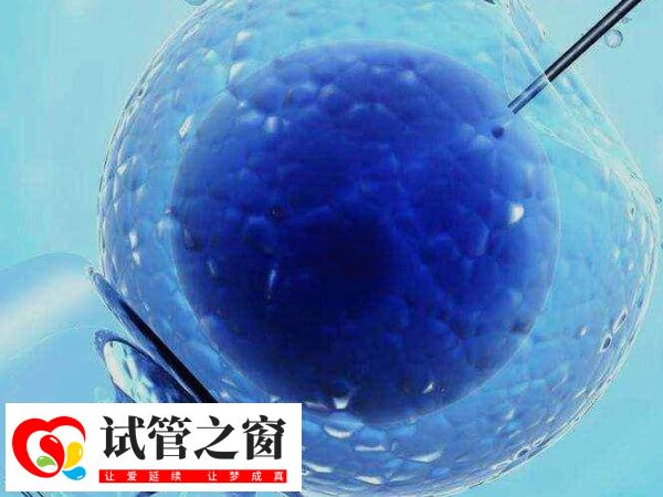 试管婴儿治疗期间可不可以同房(图1) 试管术前检查可以同房
