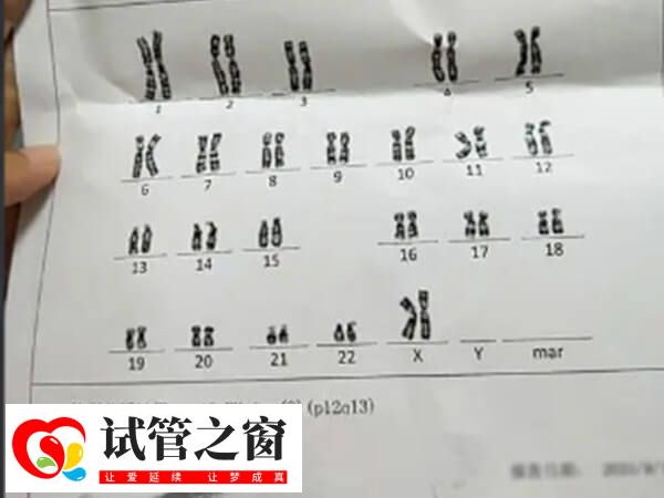 女性染色体46XXinv9p12q13必须做三代试管生孩子吗?(图1) 染色体46XXinv9p12q13是比较常见的