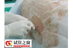 浅析试管婴儿为什么还要做宫腔镜，评估子宫