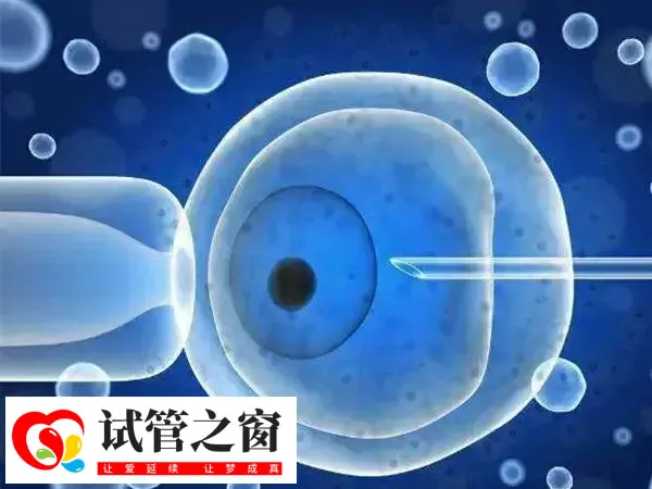 试管促排药会不会导致小腿酸疼(图1) 试管婴儿促排期间出现小腿酸疼是可能的