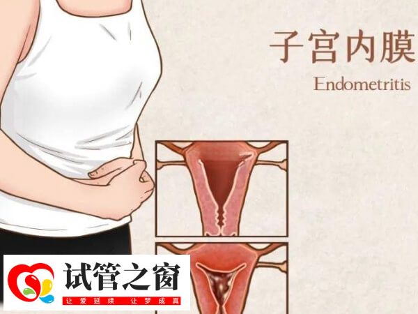 宫腔粘连的症状有哪些(图2) 子宫内膜感染也会导致宫腔粘连