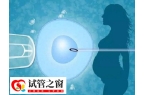 试管婴儿要满足什么条件